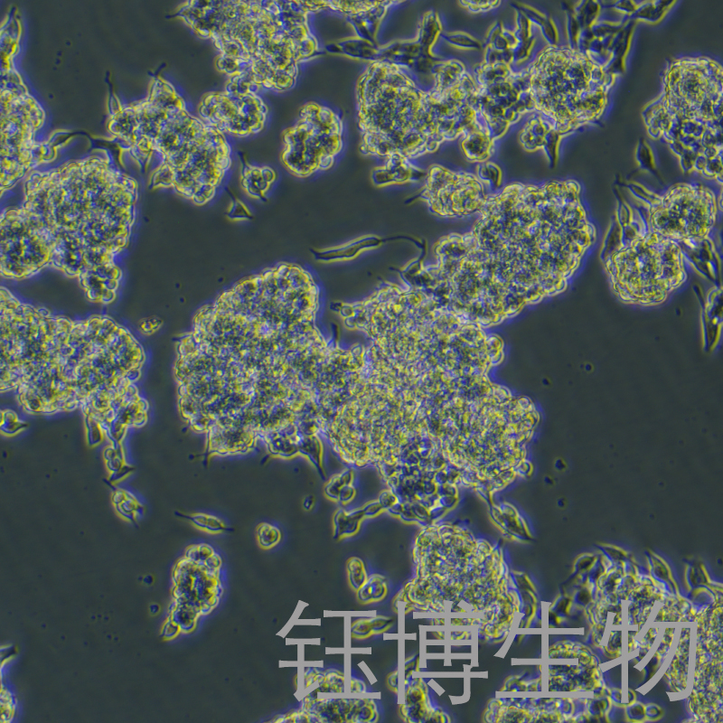 CAL-148（人乳腺癌细胞）YB-72143HC,CAL-148