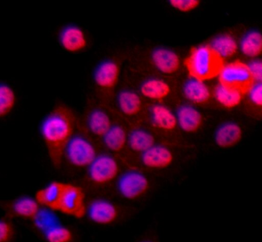 人冠状动脉平滑肌细胞,Human coronary artery endothelial cells