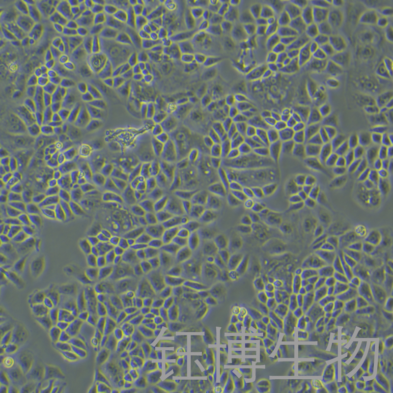 CAL51（人乳腺癌细胞（三阴性））YB-72149HC,CAL51