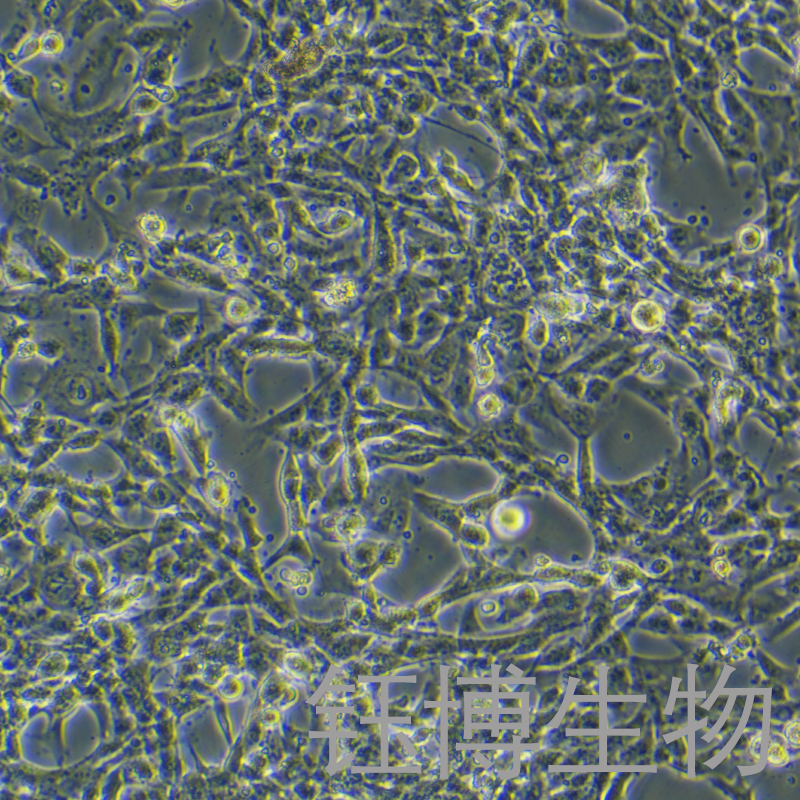 12Z（人源子宫内膜异位细胞）YB-75664HC,12Z