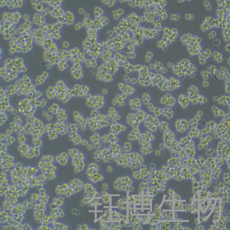 A20-Luc（小鼠B细胞淋巴瘤细胞带荧光素酶）YB-7037MC-L,A20-Luc
