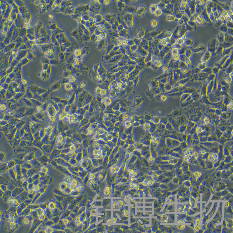 A375/DDP（人恶性黑色素瘤细胞顺铂耐药株）YB-71014HCR,A375/DDP