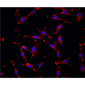 人骨髓来源内皮祖细胞,Endothelial progenitor cells derived from human bone marrow