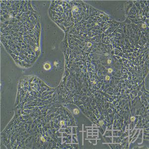 LCLC97TM1（人大细胞肺癌）YB-72146HC