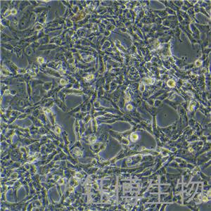 12Z（人源子宫内膜异位细胞）YB-75664HC