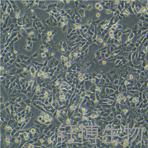 A375/DDP（人恶性黑色素瘤细胞顺铂耐药株）YB-71014HCR