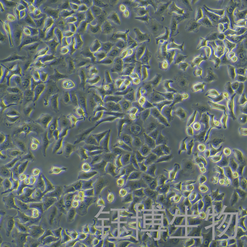 A549-GFP（人肺癌细胞带绿色荧光）YB-71016HC-G,A549-GFP