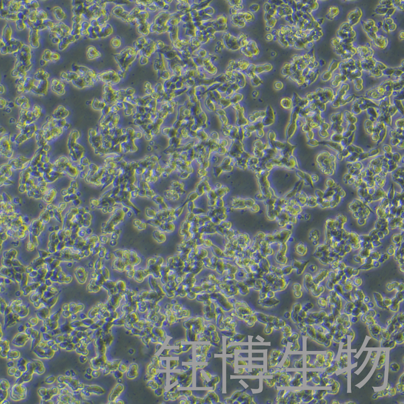 alphaTC1clone6（小鼠胰岛素瘤胰岛a细胞）YB-75673MC,alphaTC1clone6