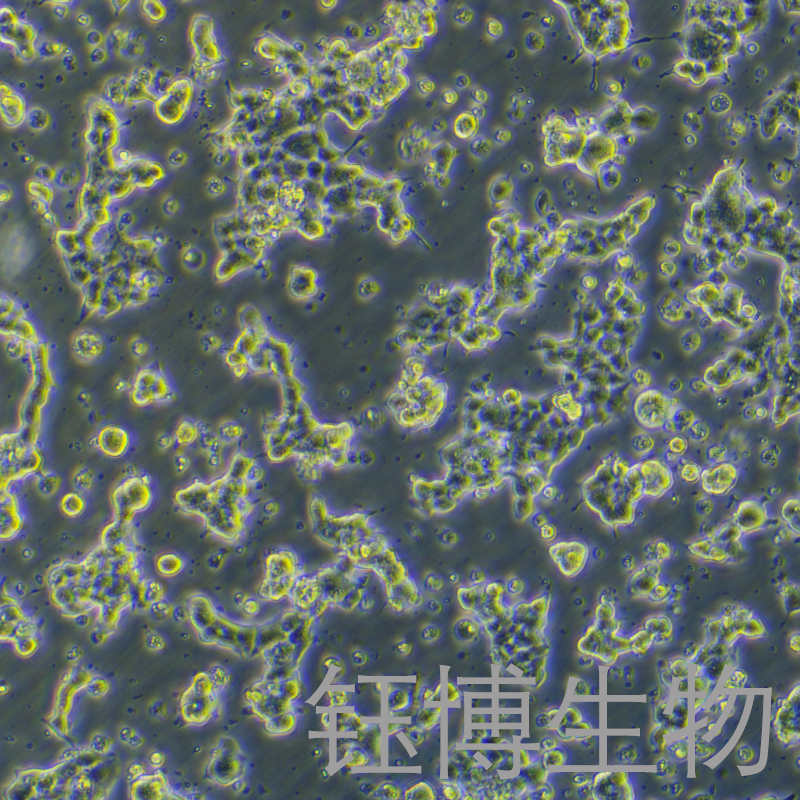 alphaTc1 clone 9（小鼠胰岛细胞腺瘤）YB-75674MC,alphaTc1 clone 9