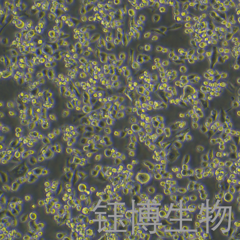 ASPC-1/GEM（人转移胰腺腺癌细胞吉西他滨耐药株）YB-71027HCR,ASPC-1/GEM