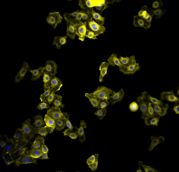 人卵巢癌腺癌细胞NIH:OVCAR-3,NIH:OVCAR-3