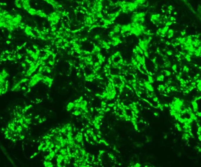 人肺大静脉平滑肌细胞,Smooth muscle cells of human pulmonary vein
