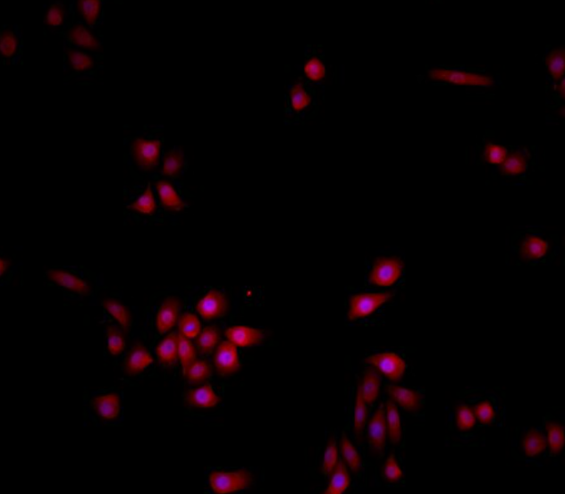 人肺微血管内皮细胞,Human pulmonary microvascular endothelial cells
