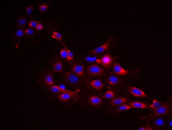 大鼠大隐静脉平滑肌细胞,Rat Saphenous Vein Smooth Muscle Cells