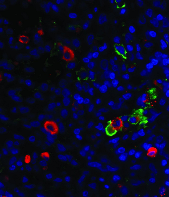 人甲状腺癌细胞FTC-133,FTC-133