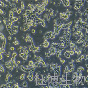 alphaTc1 clone 9（小鼠胰岛细胞腺瘤）YB-75674MC