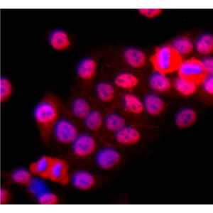 人口腔角质形成细胞,Human oral keratinocytes
