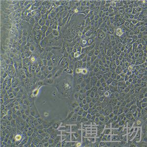 BxPC-3-LUC（人原位胰腺腺癌细胞-荧光素酶标记）YB-71042HC-L