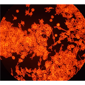 人肺大动脉平滑肌细胞,Smooth muscle cells of human pulmonary artery