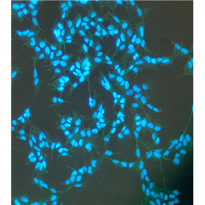 人乳腺导管瘤细胞UACC-812