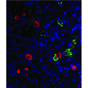 人甲状腺癌细胞FTC-133