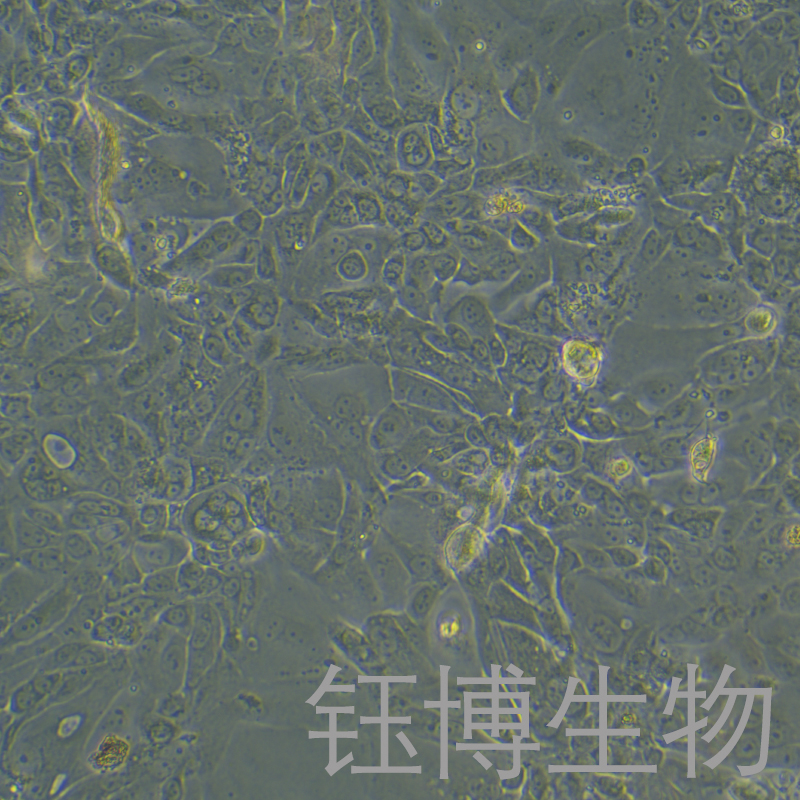 Capan-2-LUC（人胰腺癌细胞（luc标记））YB-75691HC-L,Capan-2-LUC