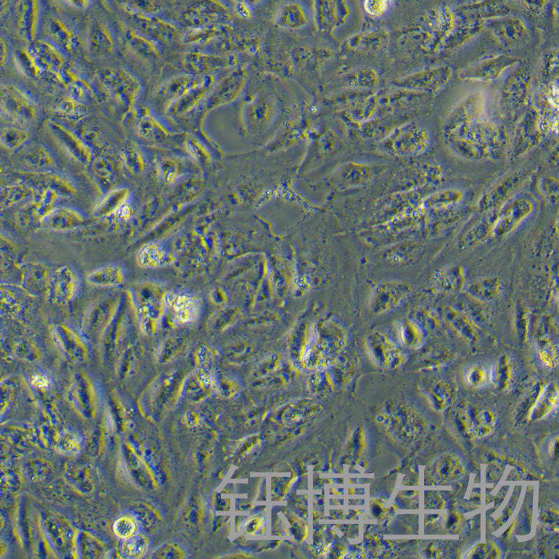 Daoy-LUC（人髓母细胞瘤细胞（luc标记））YB-71615HC-L,Daoy-LUC