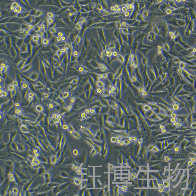 DCS（小鼠树突状细胞肉瘤细胞）YB-75706MC,DCS