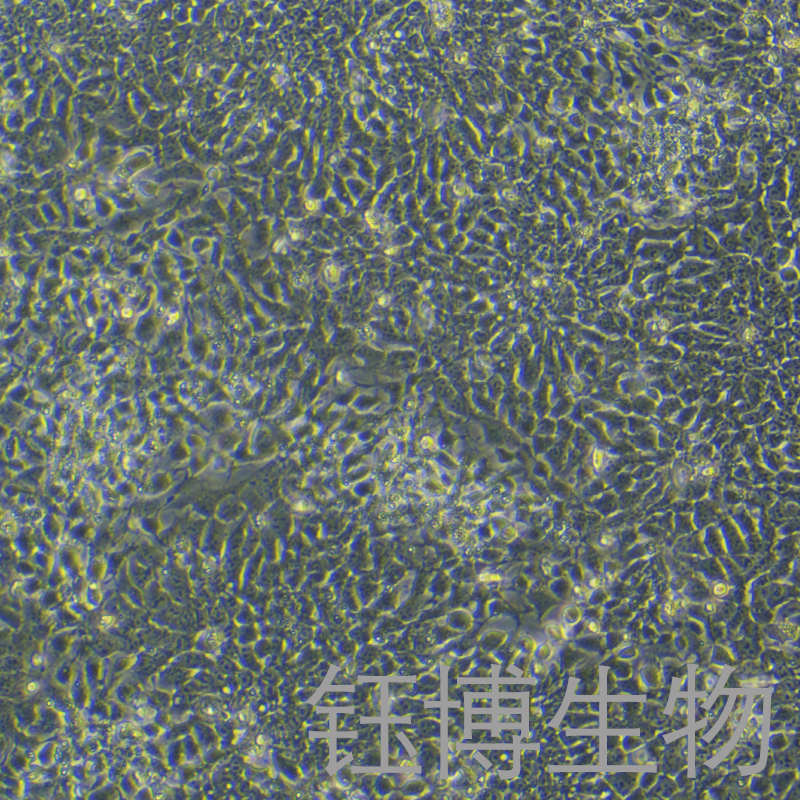 H1（人胚胎干细胞）YB-75722HC,H1