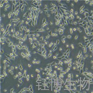 GIST-T1（人胃肠道间质瘤细胞）YB-75720HC