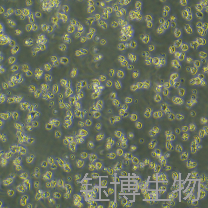 HKBML（淋巴瘤细胞）YB-75750HC,HKBML