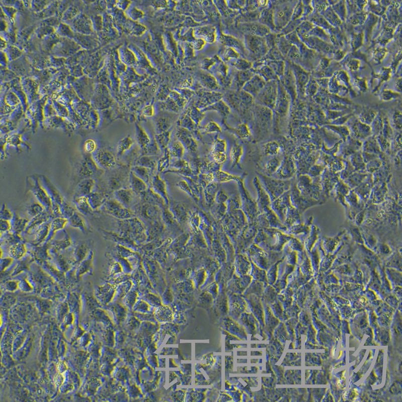 Huh-7 sorafenib（人肝癌索拉非尼耐药株）YB-71120HCR2,Huh-7 sorafenib