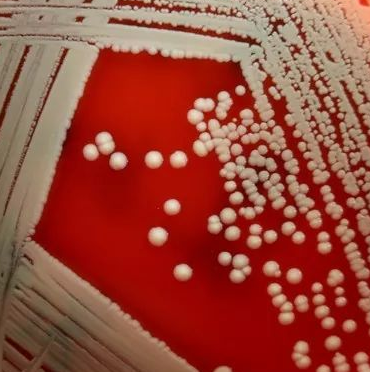 Clostridium Felsineum,Clostridium Felsineum