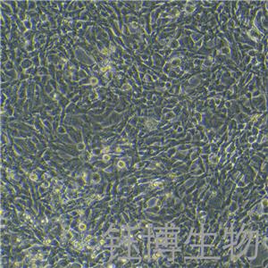 HCMEC（人心脏微血管内皮细胞）YB-75732HC