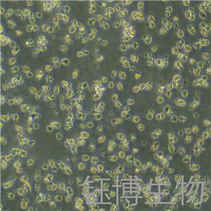 HKBML（淋巴瘤细胞）YB-75750HC,HKBML