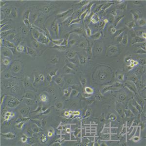 HSC-2(人口腔鳞状肿瘤细胞)YB-75766HC