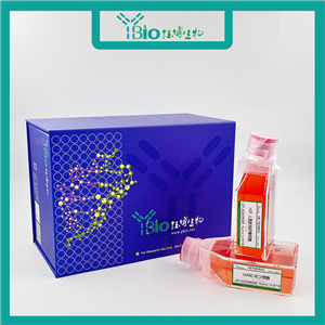 HuH-7-GFP（人肝癌细胞（GFP标记））YB-71120HC-G