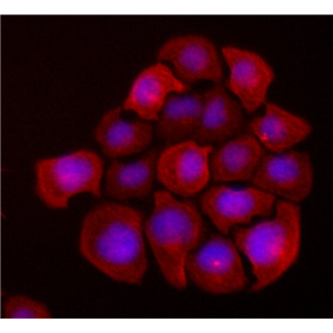 人髓母细胞瘤组织源细胞