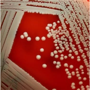 Clostridium Felsineum