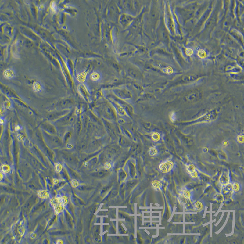 JHH-6（肝细胞癌细胞）YB-75777HC,JHH-6