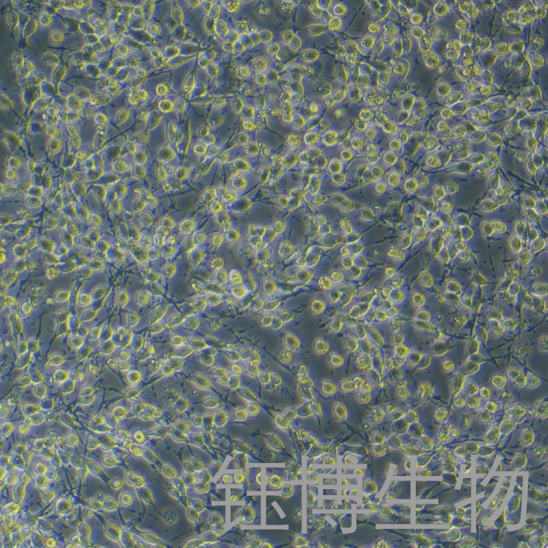 MADB106-luc（大鼠乳腺癌细胞-荧光素酶标记）YB-73148RC-L,MADB106-luc