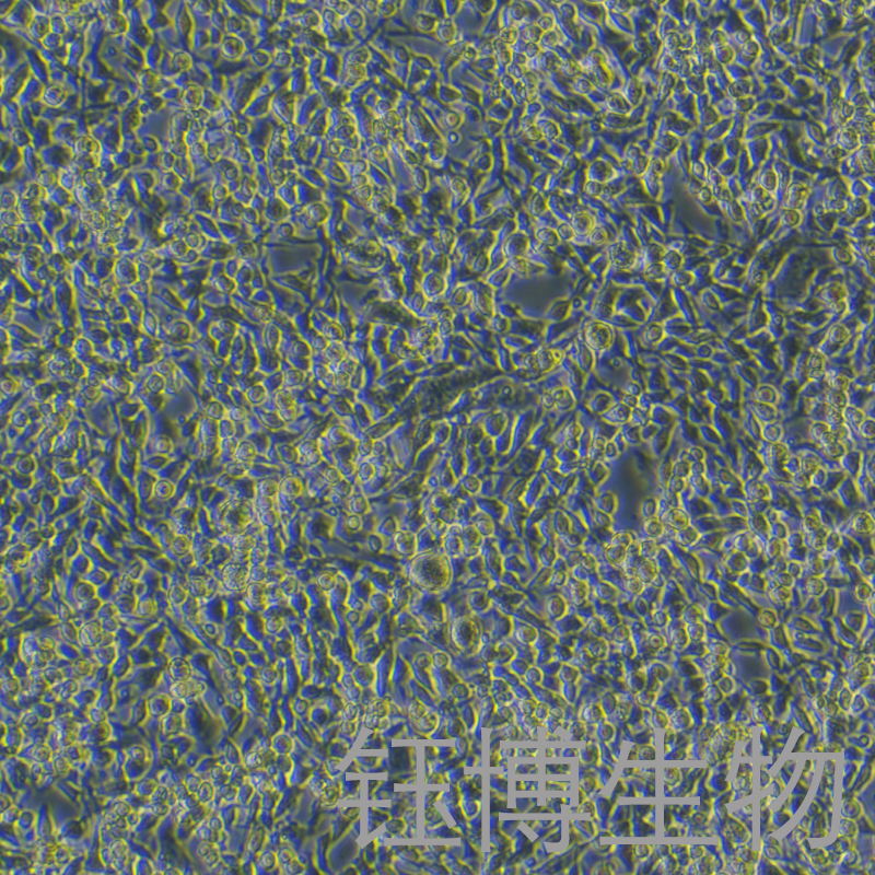 MB49-LUC（小鼠膀胱癌细胞-荧光素酶标记）YB-7034MC-L,MB49-LUC