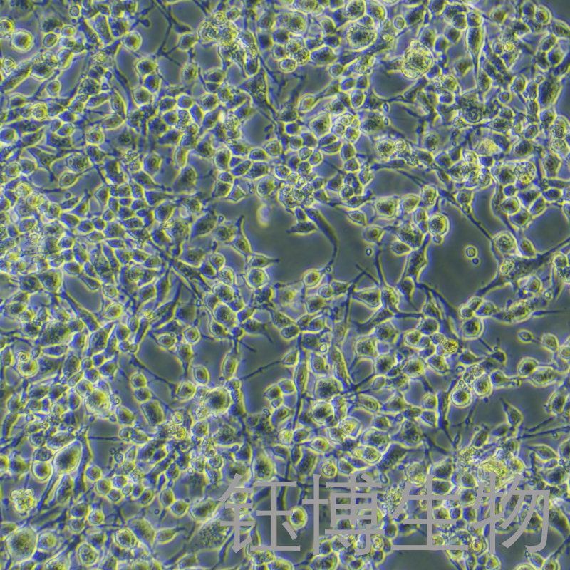 MC38-OVA-LUC（小鼠结肠癌细胞株转染）YB-72479MC-OL,MC38-OVA-LUC