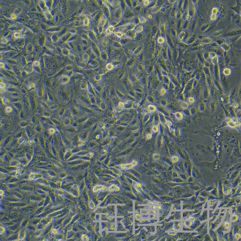 MDA-MB-231/DDP-GFP（人乳腺癌顺铂耐药株）YB-71150HCR-G,MDA-MB-231/DDP-GFP