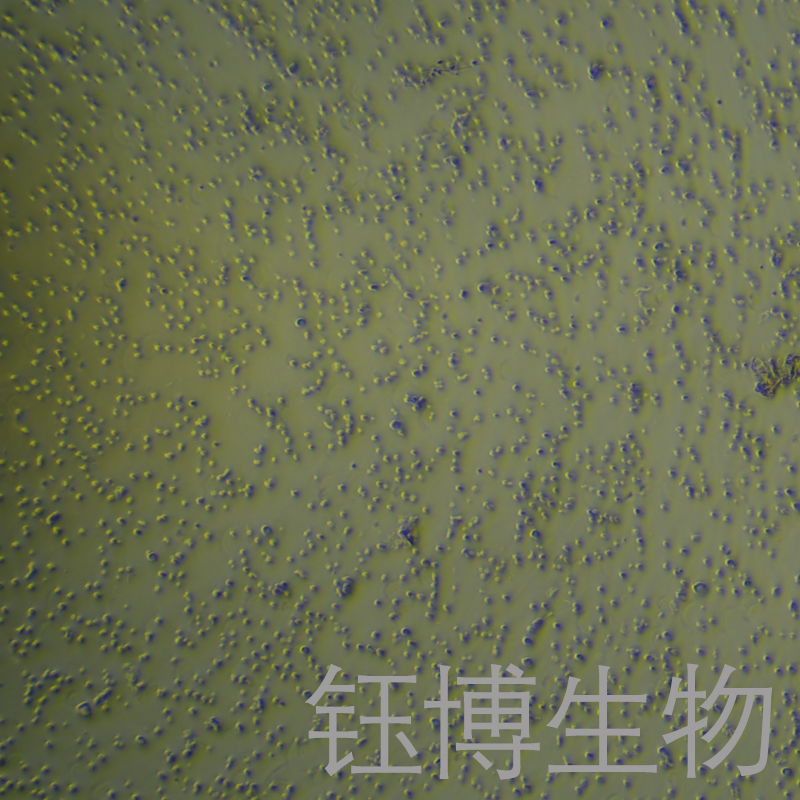 NALM-6-LUC（人B淋巴白血病细胞-荧光素酶标记）YB-71782HC-L,NALM-6-LUC