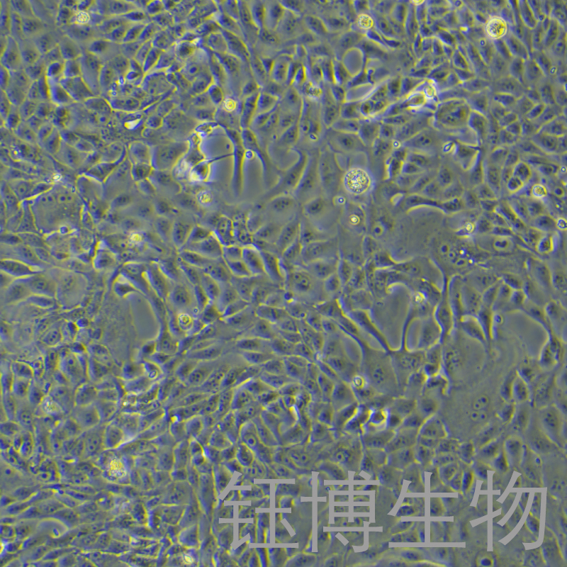 MDCK [NBL-2]（犬肾细胞）YB-75825OC,MDCK [NBL-2]
