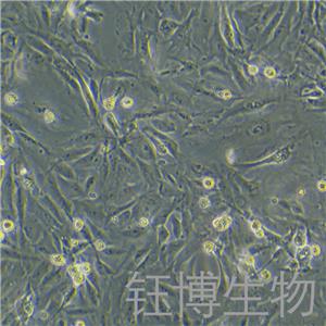 JHH-6（肝细胞癌细胞）YB-75777HC,JHH-6