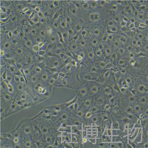 KURAMOCHI（人卵巢癌细胞）YB-75787HC