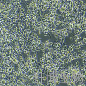 MC38-OVA-LUC（小鼠结肠癌细胞株转染）YB-72479MC-OL