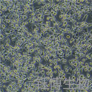 MFC-LUC-GFP-Puro（小鼠前胃癌细胞-红色荧光蛋白-荧光素酶标记）YB-72156MC-LGP